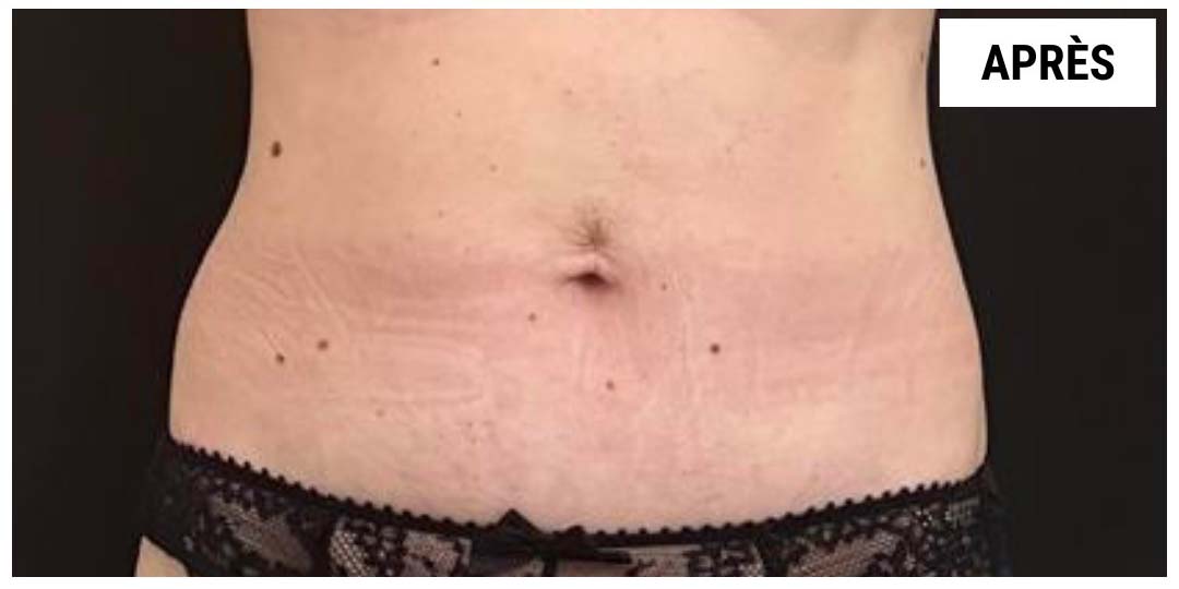 Hydrologie du côlon