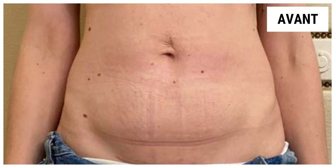 Hydrologie du côlon